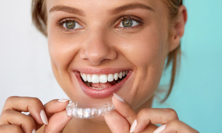 How Long Does Invisalign Take to Work Properly?