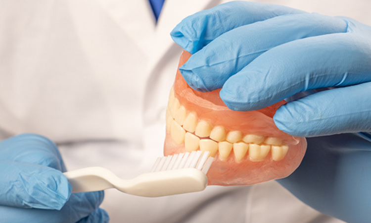How You can Clean and Take Care All on 4 Dental Implants