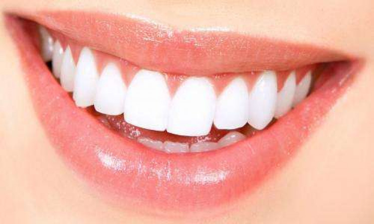 What is bad about teeth whitening?