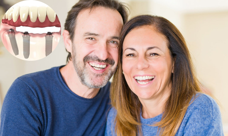 Dental Implants: Why to Choose This Permanent Tooth Replacement