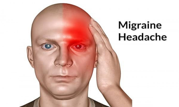 Surprising Herbal Medicine For Migraine Headache
