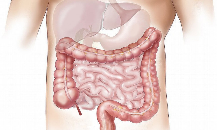 What To Expect After Colon Hydrotherapy: A Guide for Anyone Considering Colon Hydrotherapy