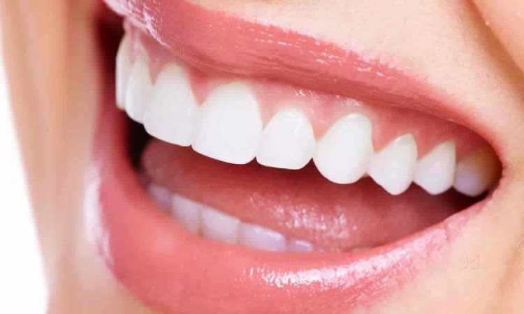 How to find the Lingual braces cost in India